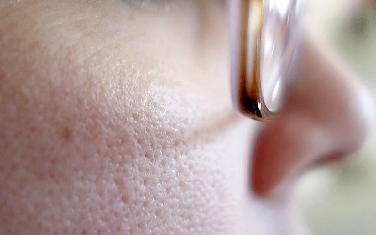 ساده‌ترین راه پیشگیری از مشکلات پوستی